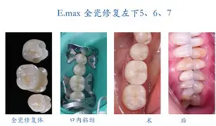 开云-剠?5{+Z&amp;磟;=^寽跾#y?o\(弜嵌洶鯫e鰱龅